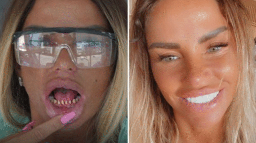 The Three Big Risks of Turkey Teeth