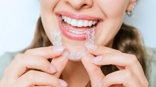 Top 10 Aligners Questions – Answered!